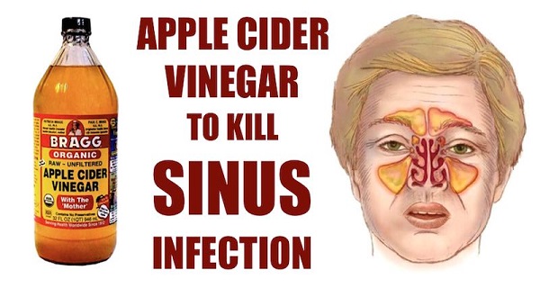 Kill-Sinus-Infection-With-apple-cider-vinegar