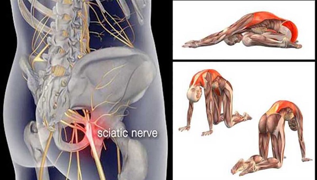 11-Piriformis-Stretches-to-Get-Rid-of-Sciatica-Hip-and-Lower-Back-Pain
