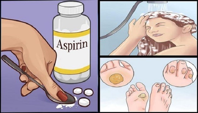 9-Most-Amazing-Uses-of-Aspirin-That-You-Have-Probably-Never-Heard-Of