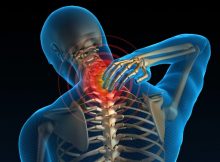 neck-pain