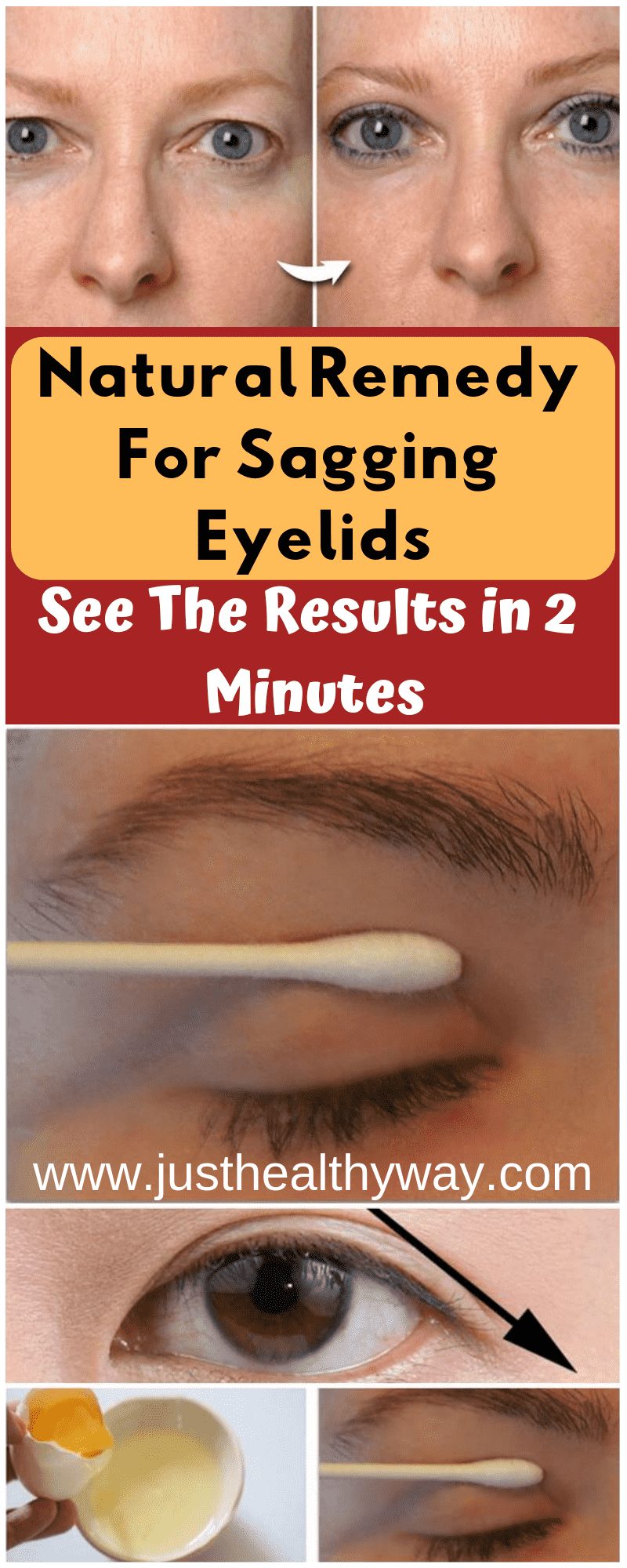 The natural remedy for sagging eyelids and hooded eyes consist of ingredients like an egg. The white part of the egg is very useful to make the skin firm and tighten it quickly.